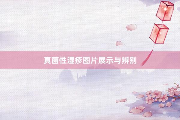 真菌性湿疹图片展示与辨别